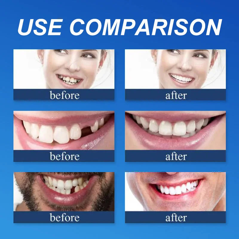 ✅ Made and Shipped from the UK| Skavix™ Suction-fit Complete Denture 🍀