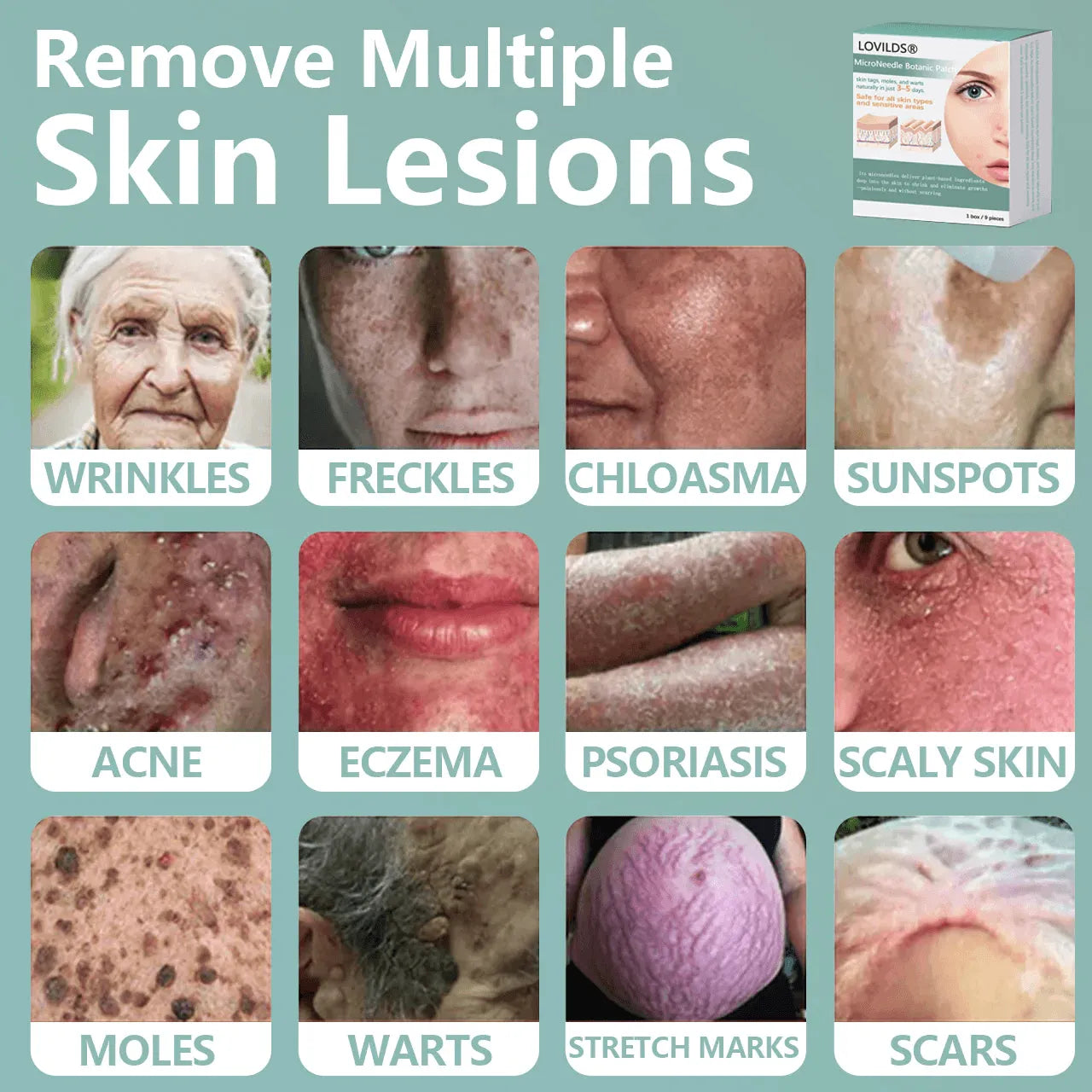 🔥Final 3 Hours: 80% OFF - LOVILDS™ Magnesium MicroNeedle Quick Remove Skin Tag Patches