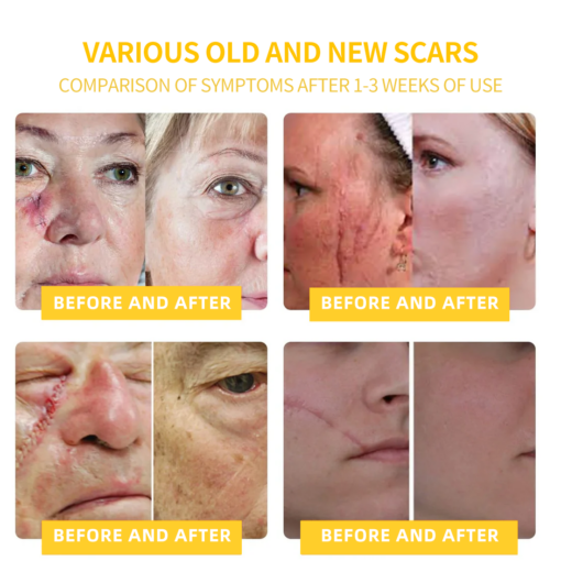 LOVILDS™ Bee Toxin Skin Repair Cream(AAD Recommended👨⚕️)