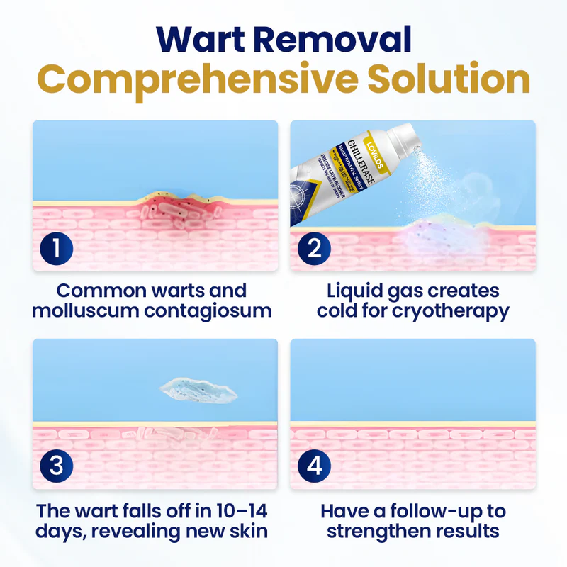 🔥𝙁𝙞𝙣𝙖𝙡 3 𝙃𝙤𝙪𝙧𝙨: 60% 𝙊𝙁𝙁: LOVILDS™ ChillErase Bump Renewal Spray🔥